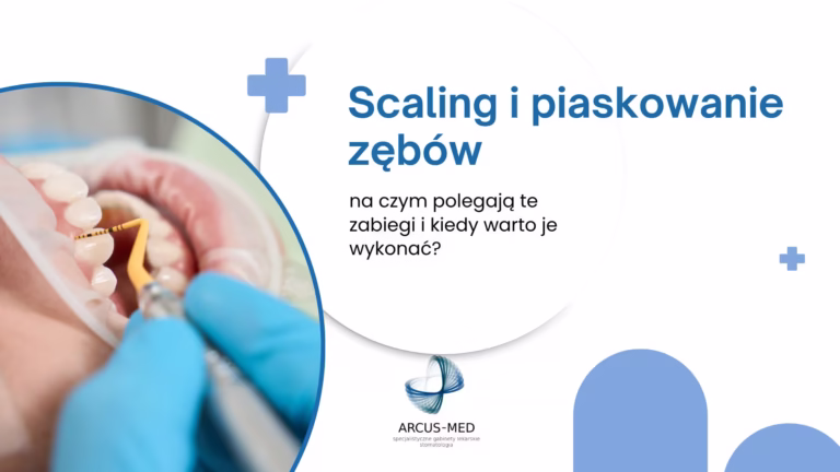 Scaling i piaskowanie zębów na czym polega