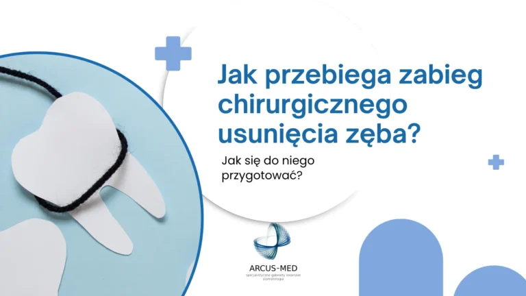 Jak przebiega zabieg chirurgicznego usunięcia zęba i jak się do niego przygotować