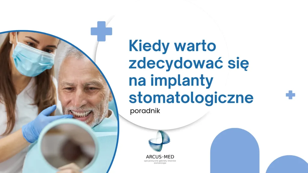 Kiedy warto zdecydować się na implanty w Częstochowie – poradnik